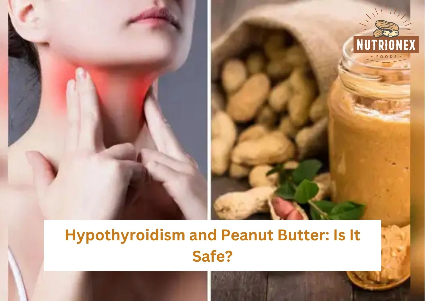 Hypothyroidism And Peanut Butter: Is It Safe?